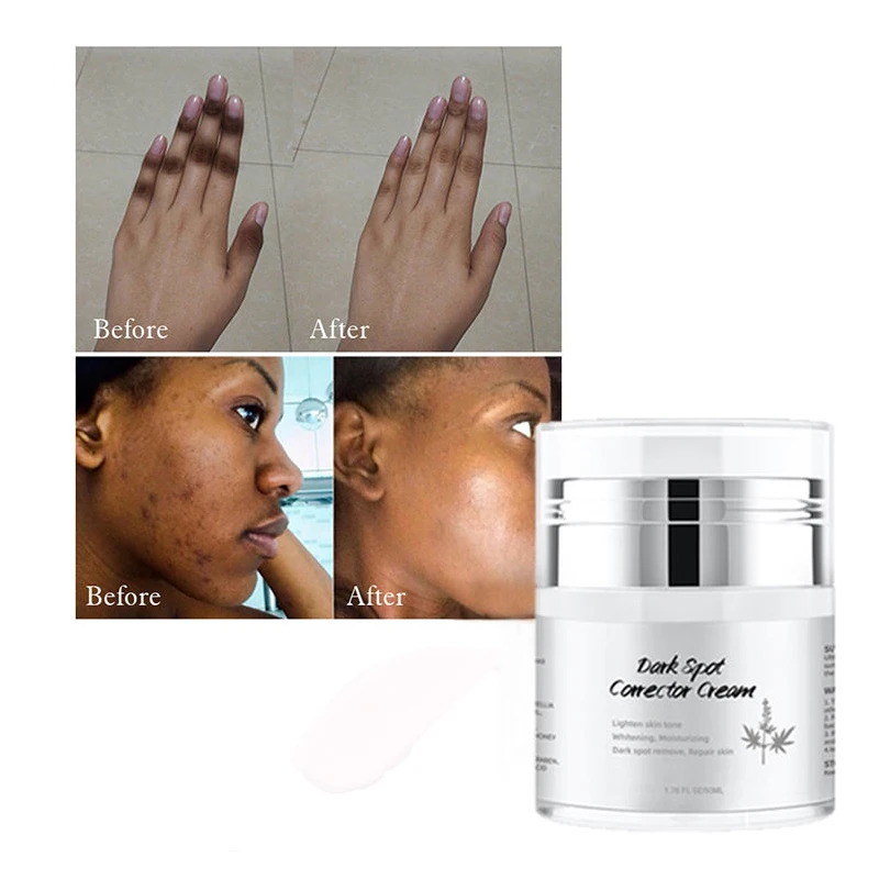 crm/additional_product_images/dark spot 2.webp